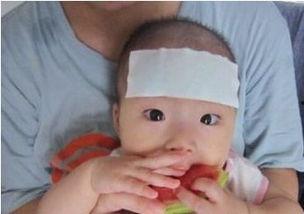 发烧吃瓜撞,一场意外引发的趣味生活记